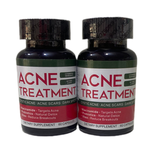 Acne Treatment